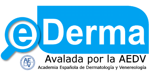unnamed (1) Ederma