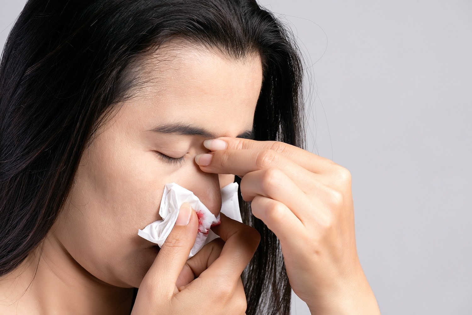 Paciente con Epistaxis Paciente con Epistaxis