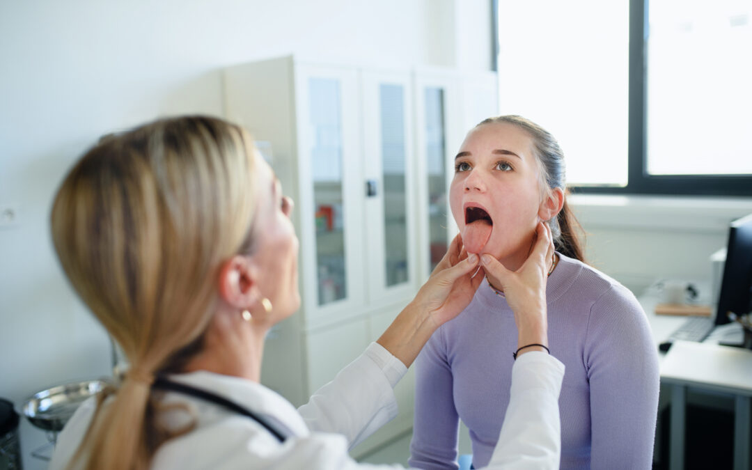 Cáncer de Amígdalas: Síntomas, Causas y Tratamientos Efectivos